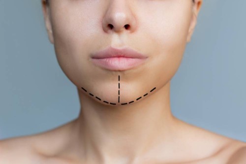 Asymetria twarzy: Wpływ na wygląd i zdrowie